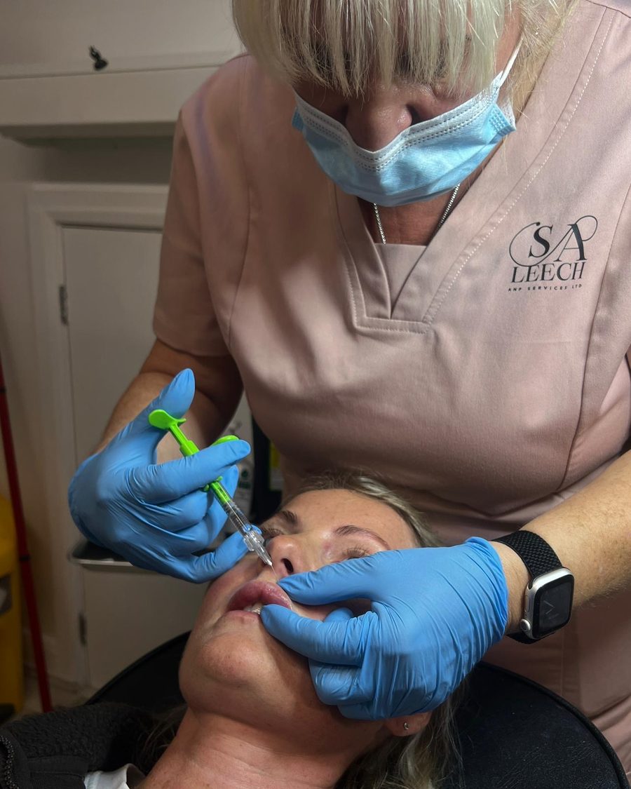 Lip filler being administered