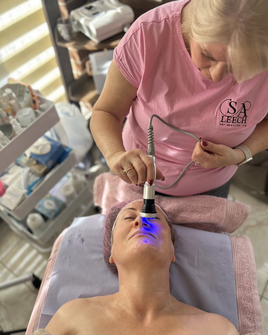 Radio frequency treatment being administered